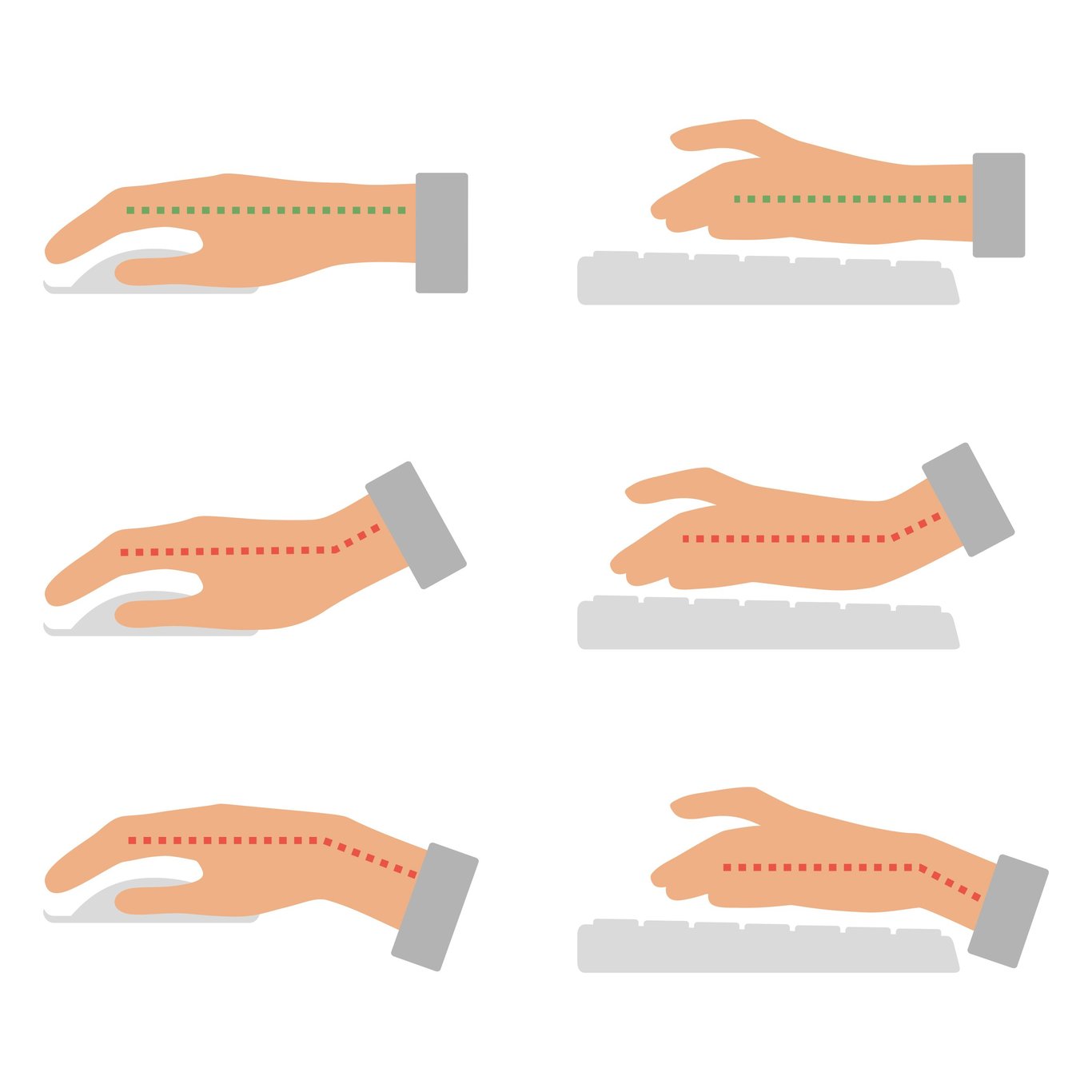 Mouse arm – 7 simple exercises and advice to avoid it | AJ Products IE